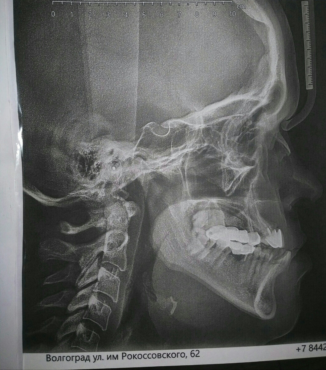 ТРГ автора.