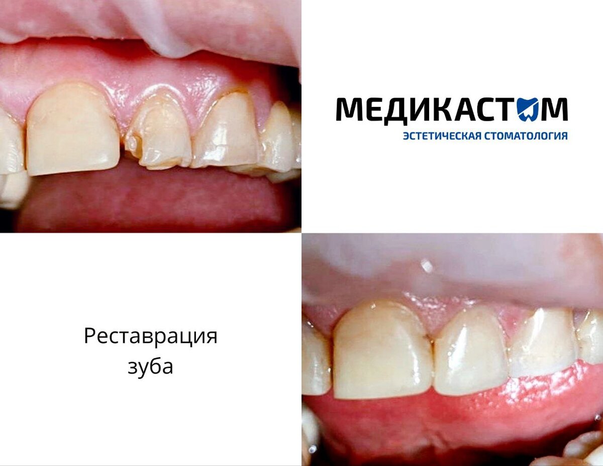 Наши центры – место, где можно получить квалифицированную помощь по всем направлениям стоматологии круглосуточно!
