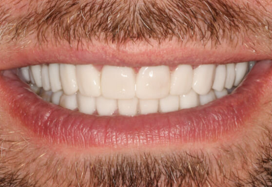 Яндекс картинки. Хочу такие зубы!