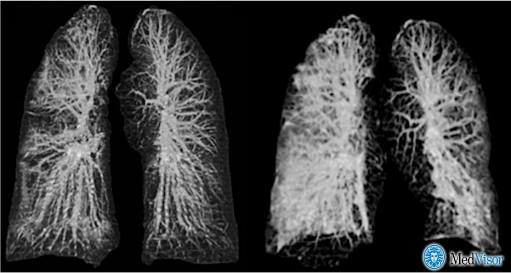 КАК РЫБА ОБ ЛЕД?