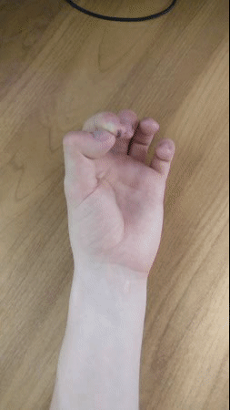 -5