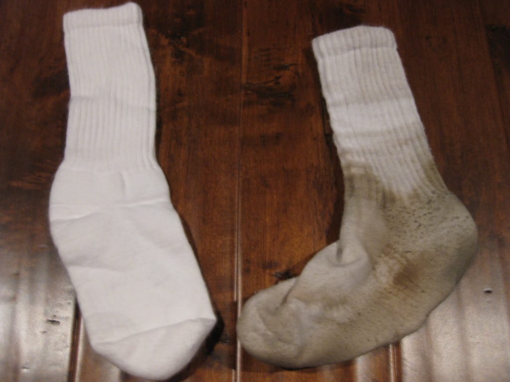 Фото до и после отбеливания