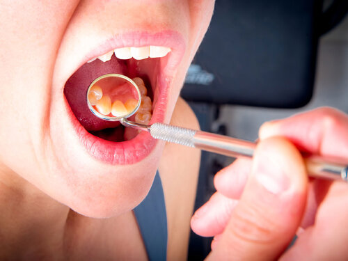 Проблемы полости рта.