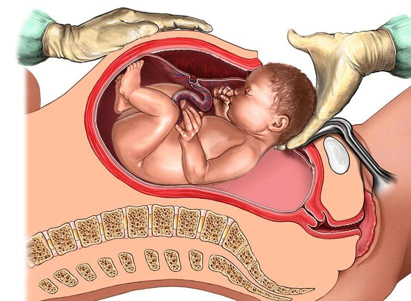 Фото позаимствовано из интернета