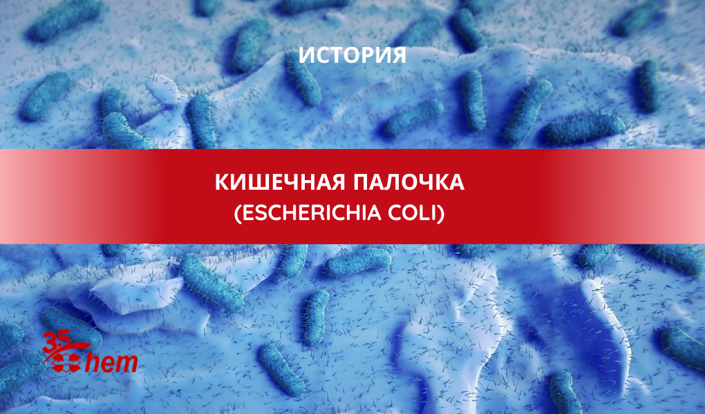 Цистит - симптомы, лечение, диагностика в Европейском Медицинском Центре