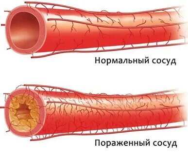Взято в открытых источниках