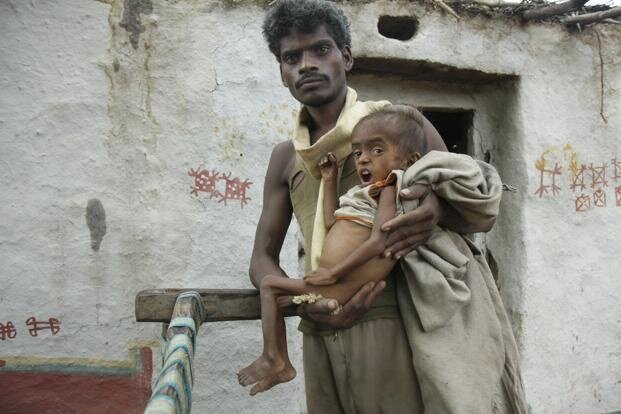 Источник: Google. Из- за плохих условий, дети часто страдают от недоедания и различных заболеваний. 