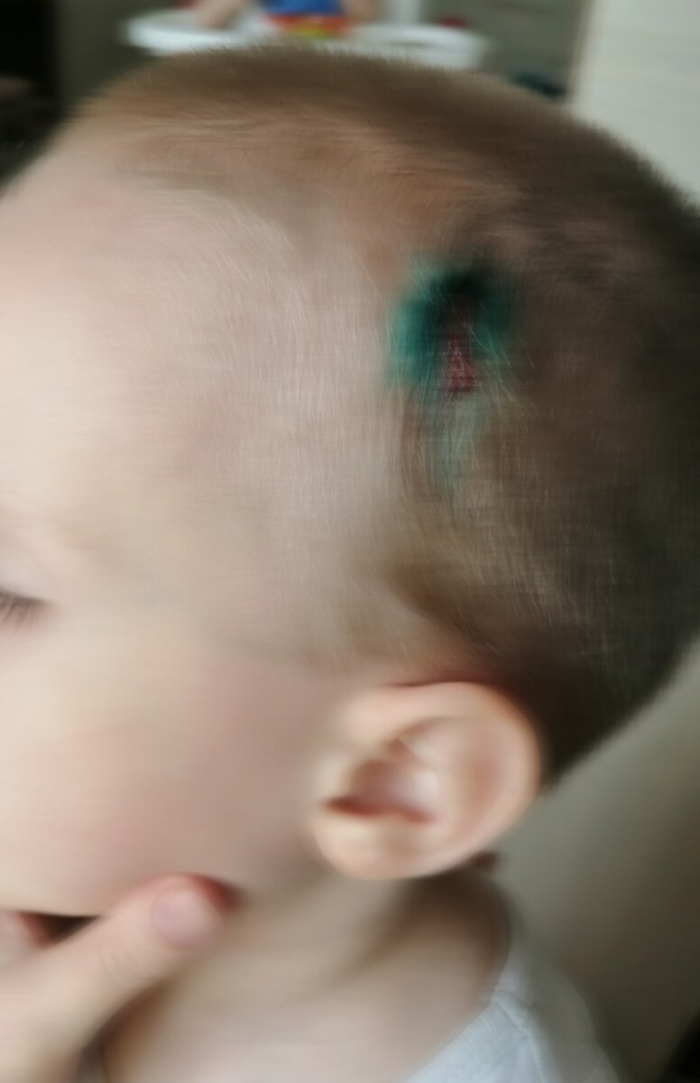 Уже обработана рана. Личное фото. 