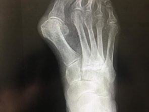 До операции