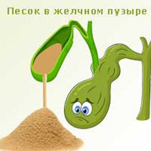 песок в желчном пузыре