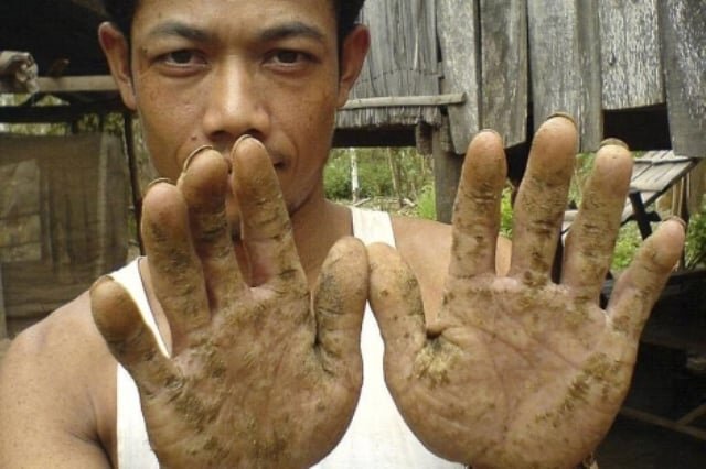 Привет, новые факты, о современной эпидемии. 