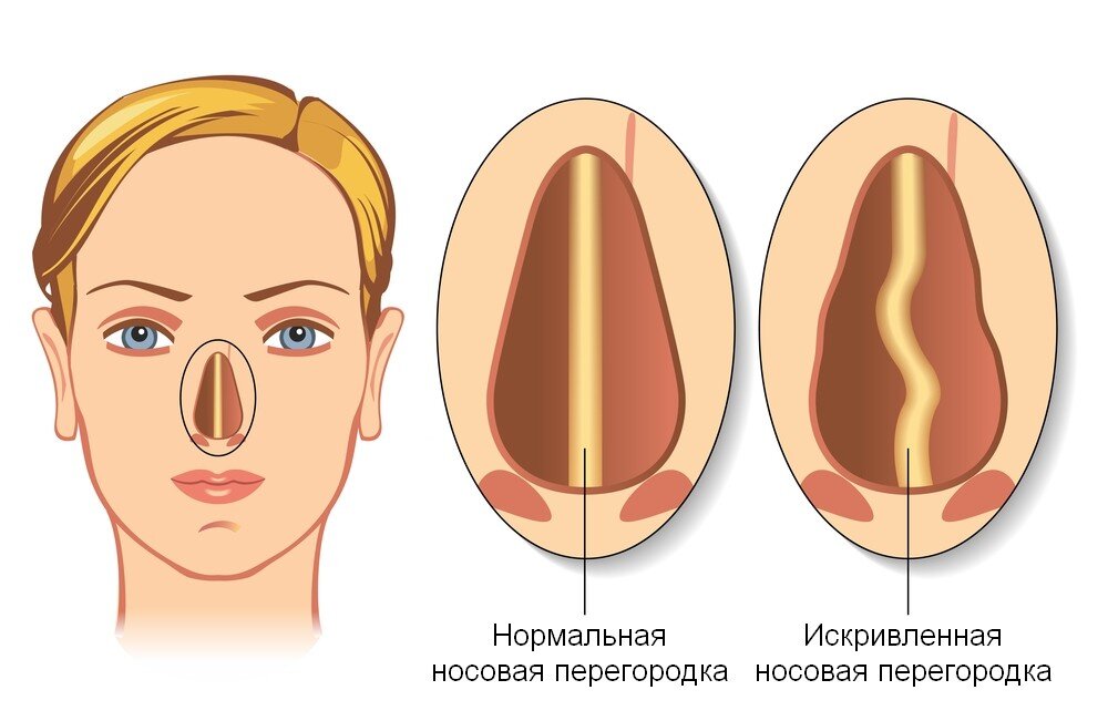 Источник Яндекс. Картинки