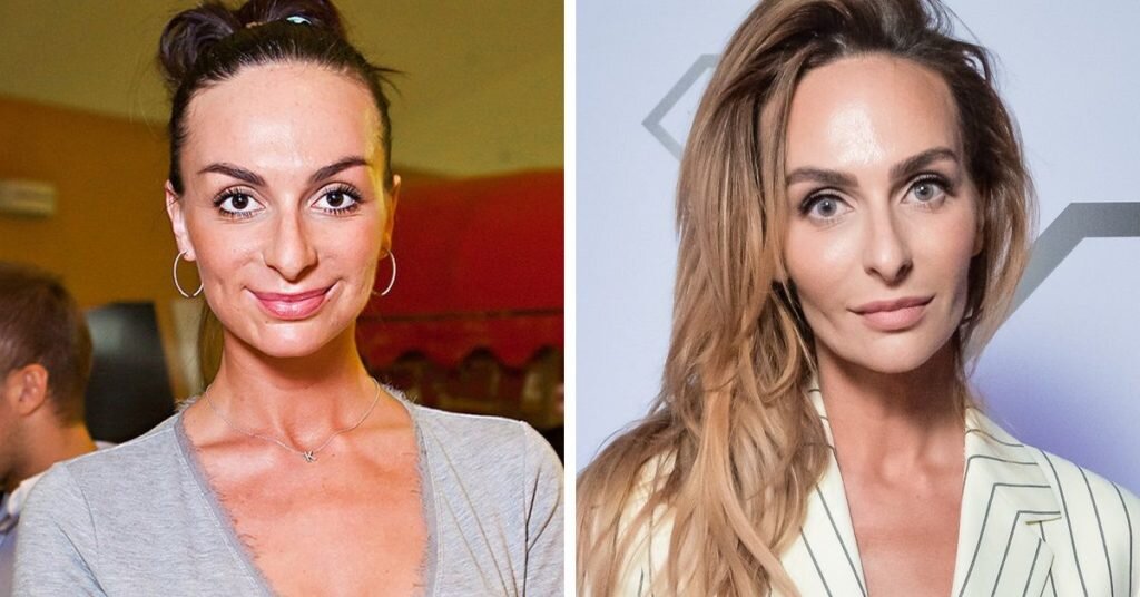 Екатерина варнава фото до и после операции Екатерина Варнава. Волшебство преображения Девичник Дзен