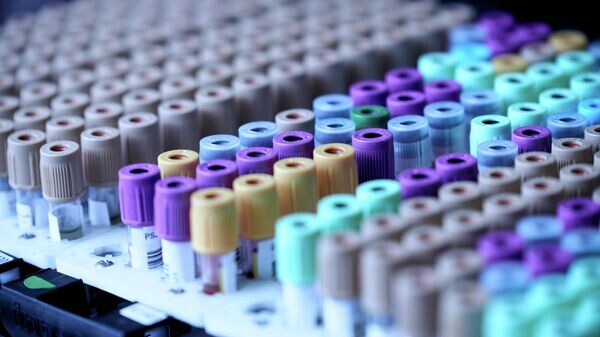   © Photo : Unsplash / Testalize.me