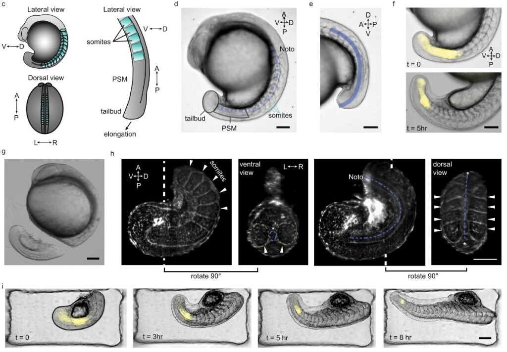 Эмбрион растет медленнее. Пгд эмбриона. Зигота эмбрион. Эмбрион растет медленнее. Эмбрион растет медленнее.
