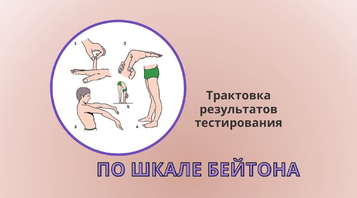 Шкала Бейтона для оценки наличия и степени гипермобильности суставов. Трактовка результатов тестирования