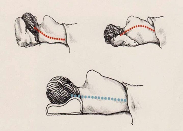 Подушка несоответствующая анатомии может привести к утренним головным болям