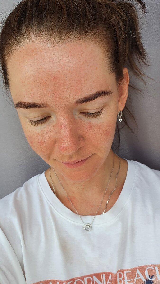 Вот так выглядела моя мордочка после издевательств.