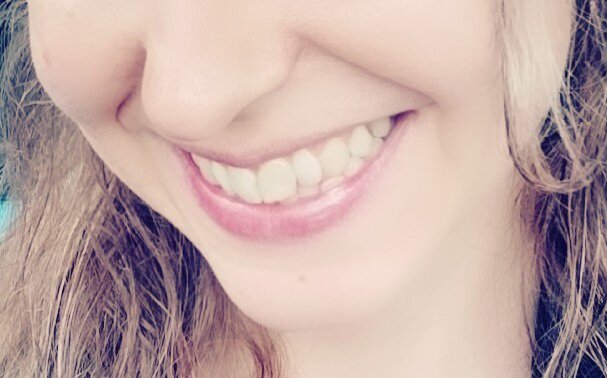 Красивая улыбка-залог успеха!