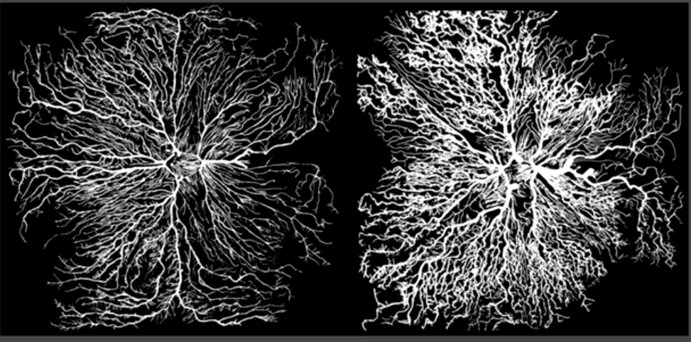 Слева – сосудистая система извозчика, справа – профессора математики П.А. Некрасова.