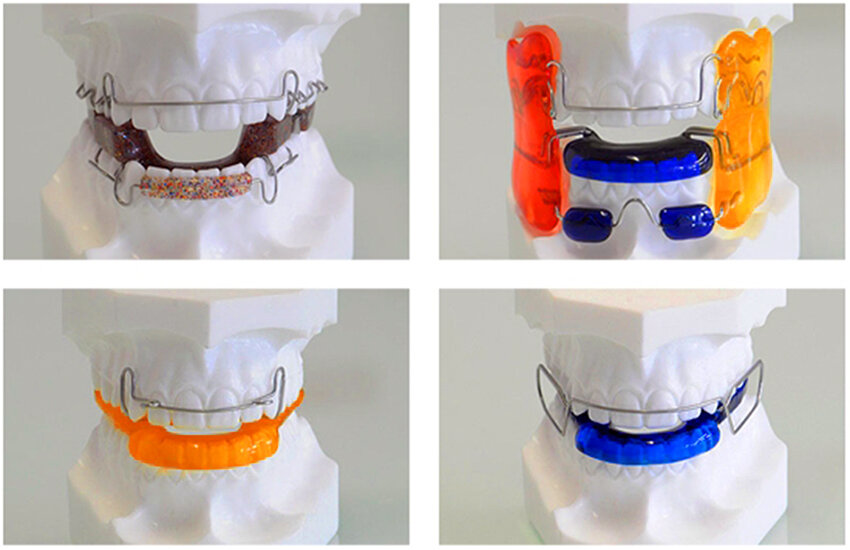 Съемные ортодонтические конструкции