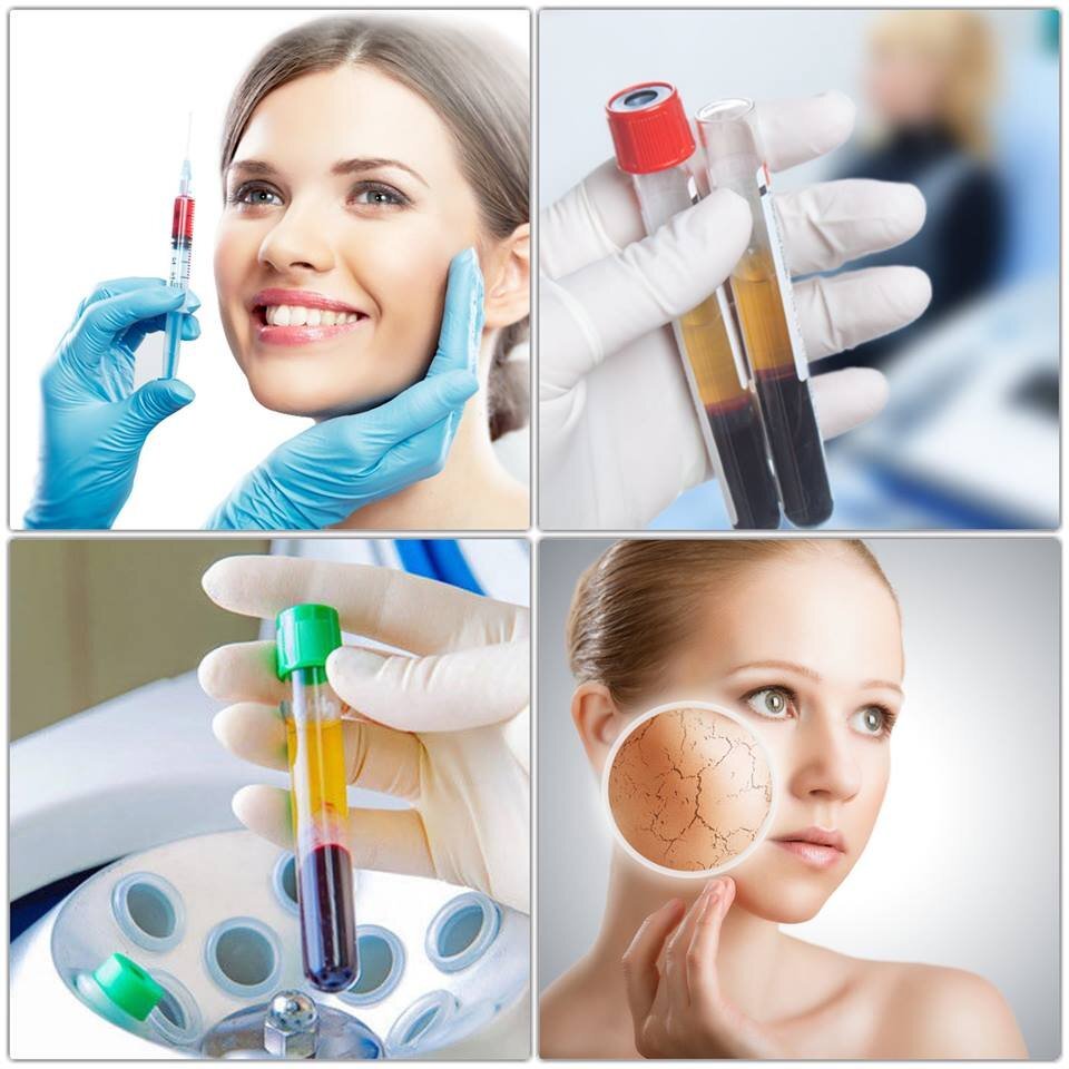 Реклама плазмолифтинга. Плазмолифтинг (плазмотерапия). Плазмолифтинг ахмерова. Плазмолифтинг для лица. Плазмолифтинг.