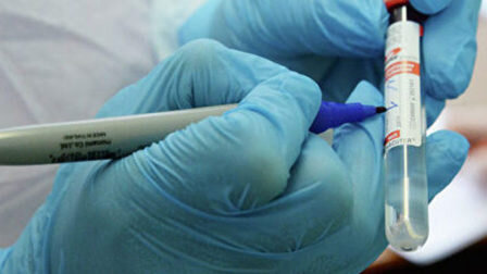 Медики в Красноярске впервые применили новый способ лечения COVID-19 — пациентам ввели антиковидную патогенредуцированную плазму, сообщила пресс-служба инфекционного госпиталя Федерального Сибирского научно-клинического центра ФМБА России.Подобный опыт лечения ранее уже опробовали в московских клиниках ФМБА России, и он показал хороший клинический эффект. В инфекционный госпиталь в Красноярске доставили 16 доз патогенредуцированной антиковидной плазмы из Центра крови ФМБА России.Плазму выделили из крови людей, заболевших коронавирусной инфекцией и успешно выздоровевших. Они добровольно сдали кровь с циркулирующими в ней антителами к коронавирусу.«Введение такой гипериммунной плазмы другим заболевшим COVID-19 – это так называемая пассивная иммунизация. Такая гипериммунная плазма может спасти жизнь пациенту с тяжелым течением заболевания — обширным поражением легких и дыхательной недостаточностью» — объяснил главный врач инфекционного госпиталя №2, врач-пульмонолог Александр Аристов.Он добавил, что иммунная система зараженного человека не всегда успевает выработать собственные антитела и это приводит к печальному исходу. Поэтому такому пациенту нужно помочь, ввести уже готовые противовирусные агенты.С учетом положительного опыта применения гипериммунной плазмы в клиниках Москвы, красноярские медики выбрали пациентов с показаниями для данной методики лечения. И в четверг впервые в регионе проведено ввели препарат двум пациентам.