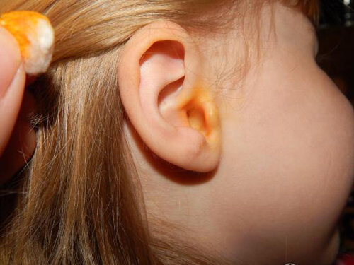 Ушки ваших детей.