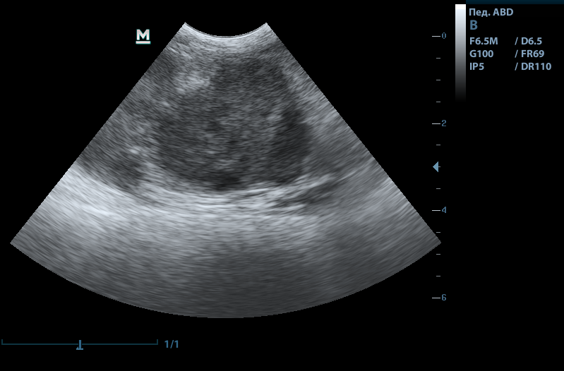 Рис.1. Новообразовательный процесс в селезенке у кота