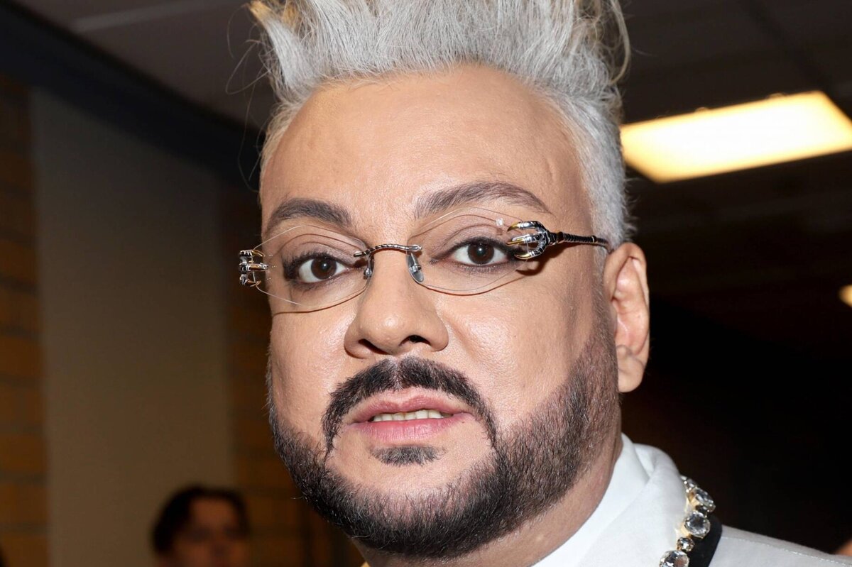     «Моя неземная красота»: Филипп Киркоров признался, что сделал пластическую операцию