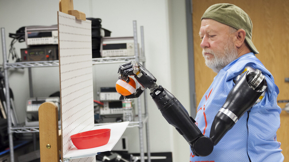 Протезы Modular Prosthetics Limbs