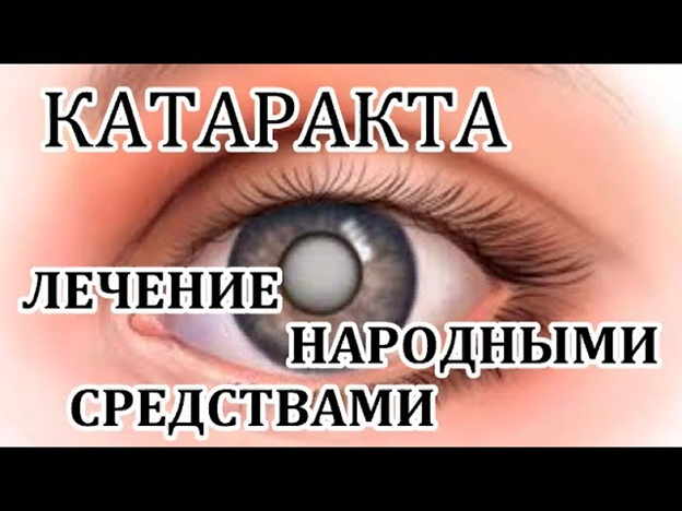 Что такое катаракта? Причины, симптомы, лечение