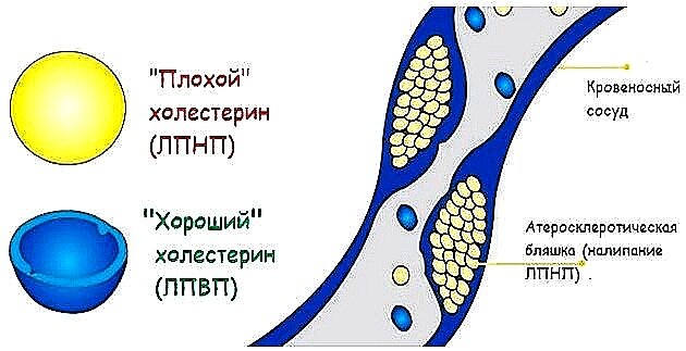 Анализ крови по оценке нарушений липидного обмена биохимический: глюкоза, холестерин, триглецириды, ЛПНП, ЛПОНП, ЛПВП, коэф.атерогенности, коэф.соотношения холестерин/триглицериды,фенотипирование сыворотки можно сделать в специализированных клиниках