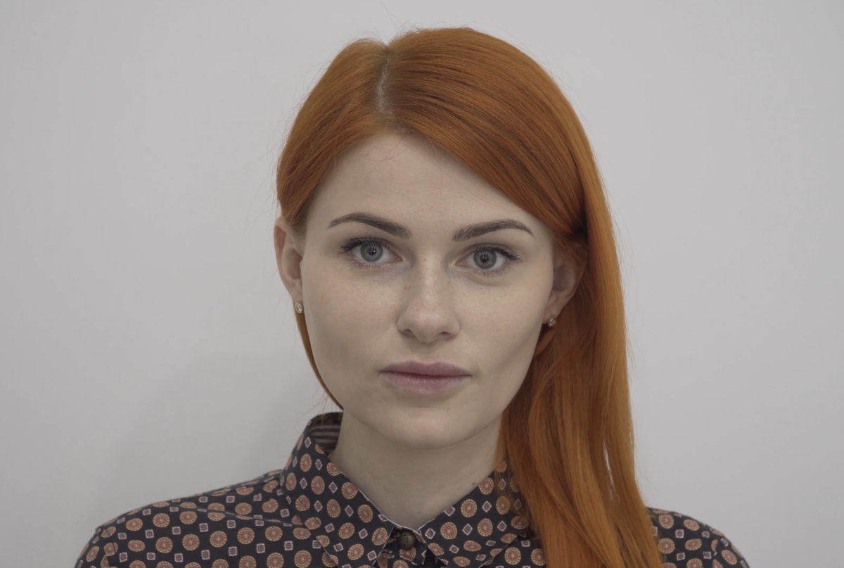 Полина до ринопластики