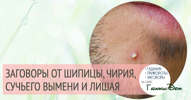 Очень неприятно, когда на теле или лице возникают гнойные образования. Заговоры от чирия и шипицы помогут вам от них избавиться и вновь очистить кожу. Попробуйте преодолеть недуг с помощью народных методов в дополнение к официальным.