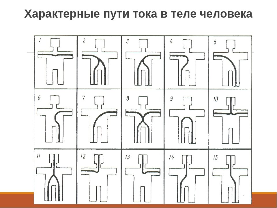 Путь протекания тока. Пути прохода тока в теле человека. Пути протекания тока через тело человека. Пути протекания электрического тока (петли тока)