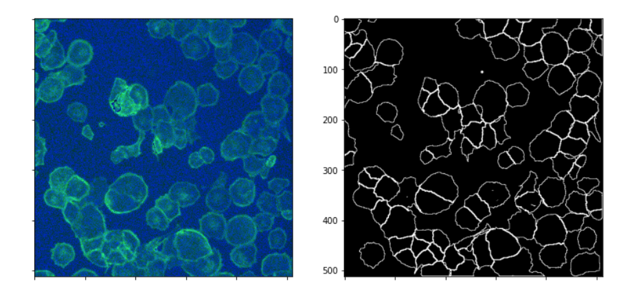 Рисунок 1: слева исходный снимок клеток, справа - выделенные границы