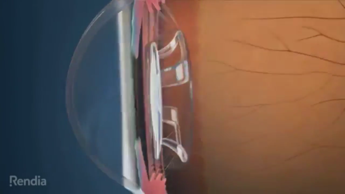 Bionic Lins на презентации 2018 года.