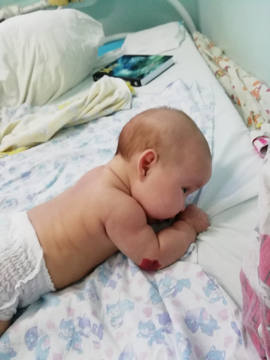 Все чаще родители встречают новорожденных детей с красными пятнами. Это гемангиома.