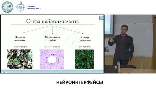 Попков В.А. - Нейроинтерфейсы от биологии до анализа данных - 4.Биосовместимость инв. нейроимплантов