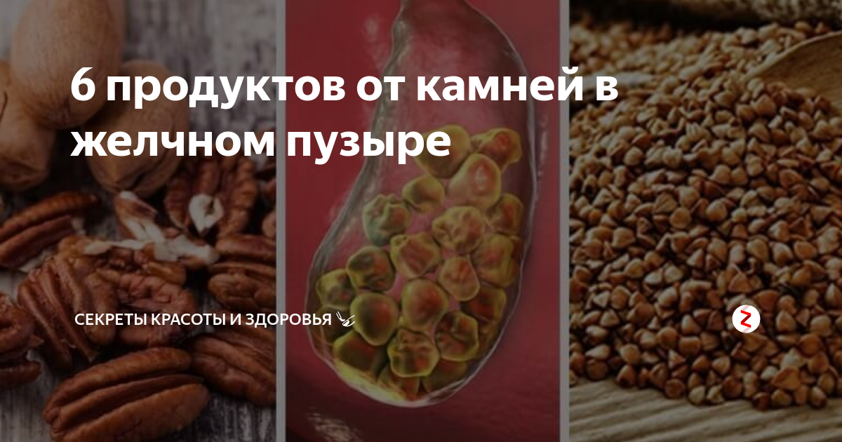 При камнях в желчном пузыре. Продукты для камни желчного пузыря. Орехи при камнях в желчном пузыре. Продукты против камней в желчном.