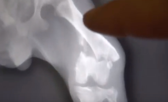 -2