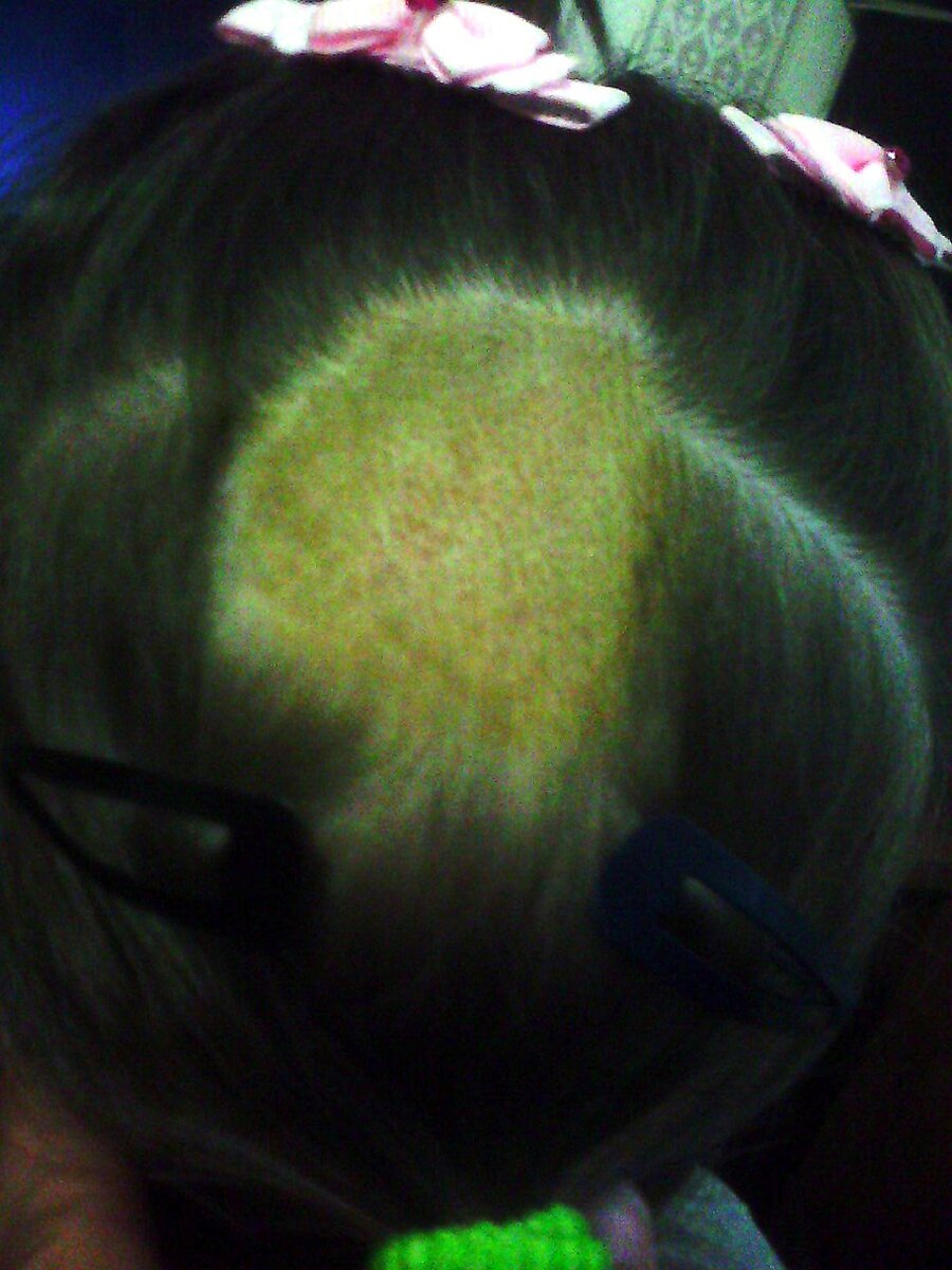 Фото сделано на следующий день после начала лечения лимоном и чесноком!