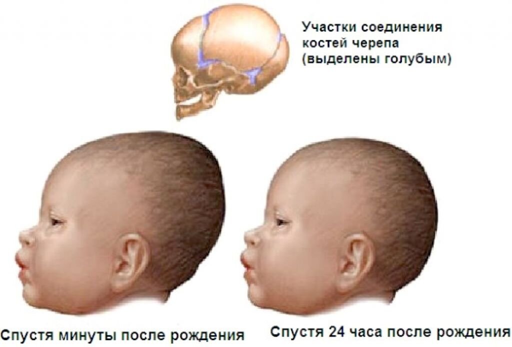 Как выглядит родничок в месяц 5 явлений у новорожденного, которые могут напугать молодых родителей Родитель см
