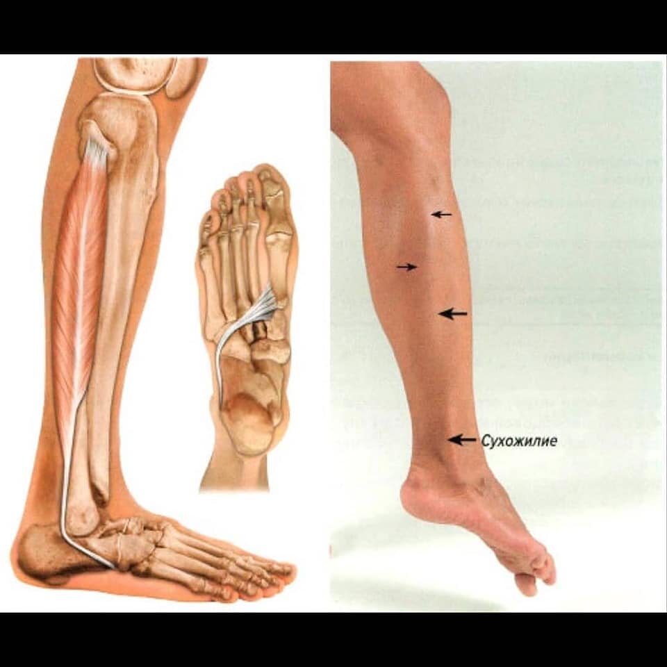 Длинная малоберцовая мышца. Короткая малоберцовая мышцы (m.Fibularis Longus). Длинная малоберцовая мышца анатомия. Сухожилия малоберцовых мышц анатомия.