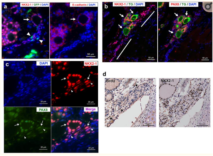 Образование фолликулов щитовидной железы из NKX2-1-позитивных нефолликулярных  клеток (из статьи Manabu Iwadate, 2018)
