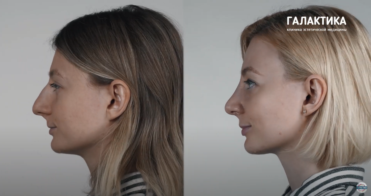 До и после операции