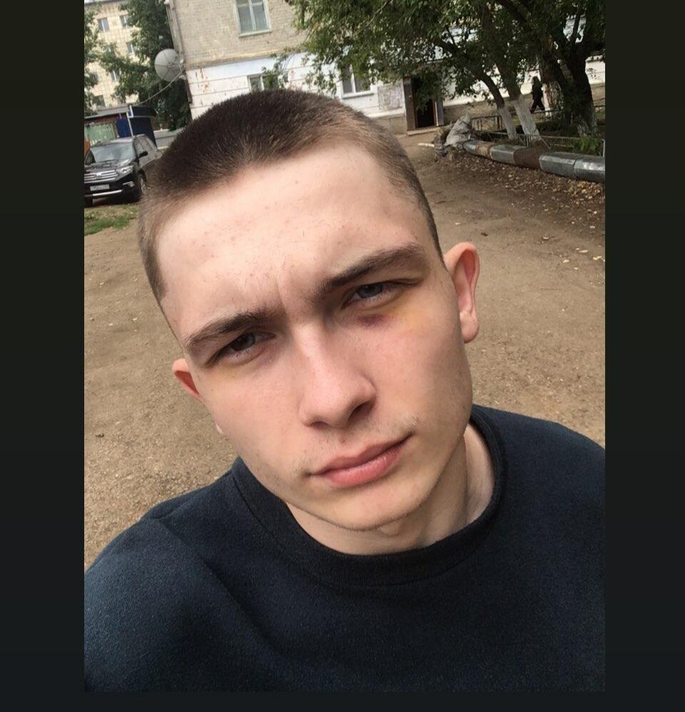 Знаю сам как гопник выгляжу. Уже почти зажили.