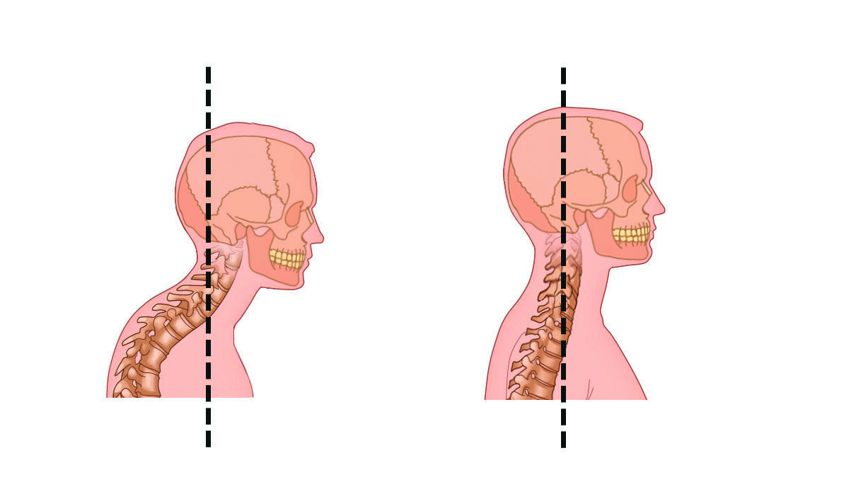 Старайтесь всегда держать спину и шею ровно.