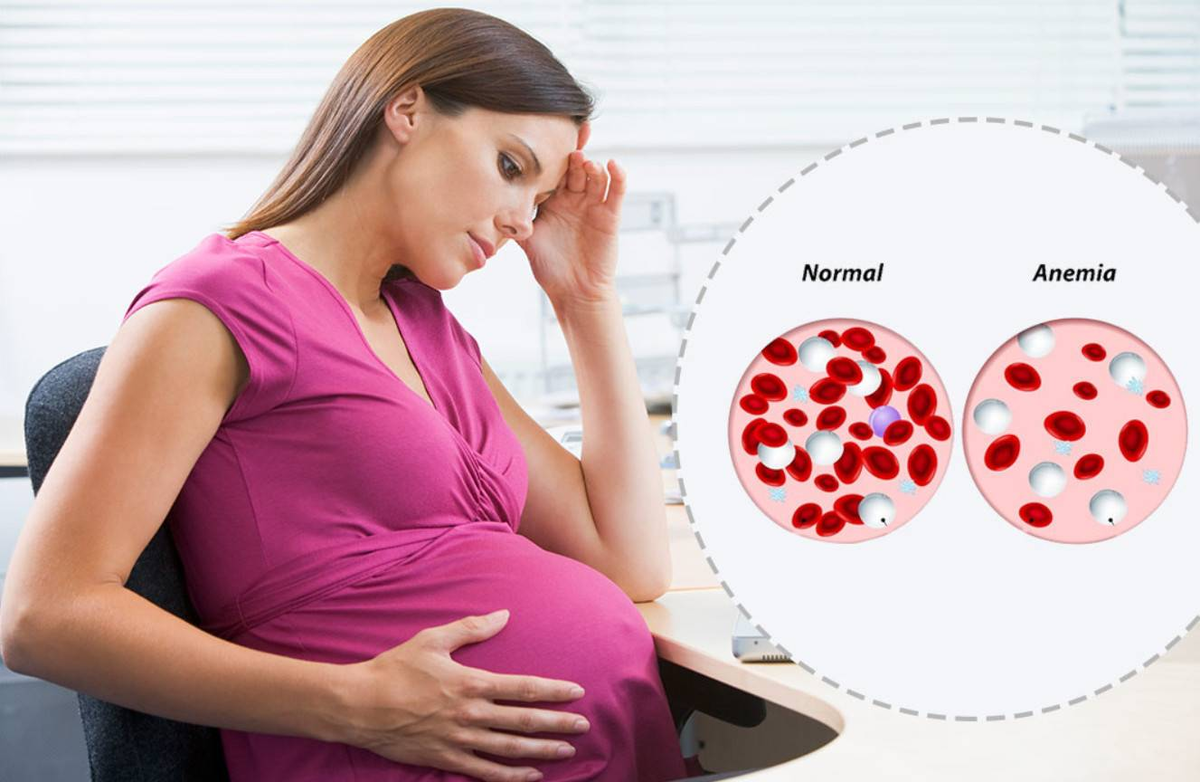 Железодефицитная анемия и беременность. Жда при беременности. Железодефицитная анемия и б. Жда анемия беременных. Гемоглобин кормящей мамы